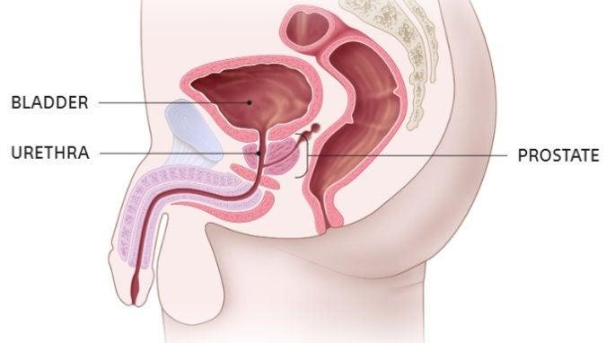 Prostate illustration showing the bladder, urethra, and prostate.